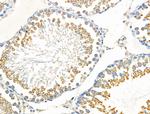 Phospho-EphA2 (Tyr930) Antibody in Immunohistochemistry (Paraffin) (IHC (P))