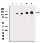 Phospho-EphA5 (Tyr650) Antibody in Western Blot (WB)