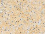 Phospho-AP2M1 (Thr156) Antibody in Immunohistochemistry (Paraffin) (IHC (P))