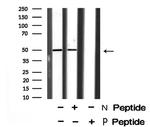 Phospho-AP2M1 (Thr156) Antibody in Western Blot (WB)