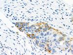 Phospho-ATP1A1 (Tyr260) Antibody in Immunohistochemistry (Paraffin) (IHC (P))