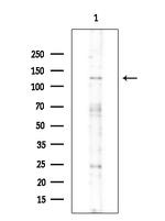 Phospho-SMC3 (Ser1067) Antibody in Western Blot (WB)