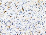 Phospho-RRAS (Tyr66) Antibody in Immunohistochemistry (Paraffin) (IHC (P))