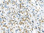 Phospho-RSK2 (Tyr529) Antibody in Immunohistochemistry (Paraffin) (IHC (P))