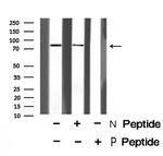 Phospho-RSK2 (Tyr529) Antibody in Western Blot (WB)