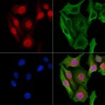 Phospho-TOP2A (Ser1337) Antibody in Immunocytochemistry (ICC/IF)