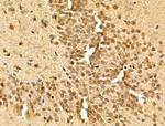 Phospho-TOP2A (Ser1337) Antibody in Immunohistochemistry (Paraffin) (IHC (P))