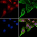 Phospho-XRCC1 (Thr284) Antibody in Immunocytochemistry (ICC/IF)