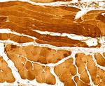 Myosin 4 Antibody in Immunohistochemistry (Paraffin) (IHC (P))