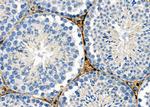 KCNE2 Antibody in Immunohistochemistry (Paraffin) (IHC (P))