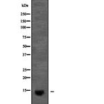 KCNE2 Antibody in Western Blot (WB)