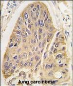 MAP2 Antibody in Immunohistochemistry (Paraffin) (IHC (P))