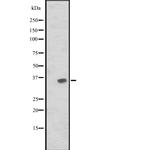 JAM2 Antibody in Western Blot (WB)