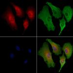 GPR30 Antibody in Immunocytochemistry (ICC/IF)