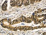 HnRNP Q Antibody in Immunohistochemistry (Paraffin) (IHC (P))