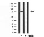 HnRNP Q Antibody in Western Blot (WB)