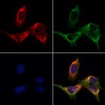 TROP2 Antibody in Immunocytochemistry (ICC/IF)