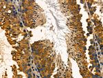 TROP2 Antibody in Immunohistochemistry (Paraffin) (IHC (P))