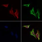 GIT2 Antibody in Immunocytochemistry (ICC/IF)