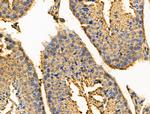 GIT2 Antibody in Immunohistochemistry (Paraffin) (IHC (P))