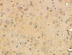 GIT2 Antibody in Immunohistochemistry (Paraffin) (IHC (P))