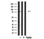 GIT2 Antibody in Western Blot (WB)