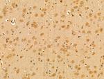 WTAP Antibody in Immunohistochemistry (Paraffin) (IHC (P))