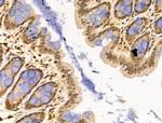 WTAP Antibody in Immunohistochemistry (Paraffin) (IHC (P))