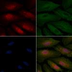 C1QBP Antibody in Immunocytochemistry (ICC/IF)