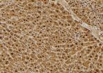 C1QBP Antibody in Immunohistochemistry (Paraffin) (IHC (P))