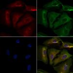 Arp3 Antibody in Immunocytochemistry (ICC/IF)