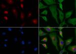 PYCARD Antibody in Immunocytochemistry (ICC/IF)