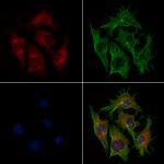 PYCARD Antibody in Immunocytochemistry (ICC/IF)