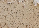 PTPN22 Antibody in Immunohistochemistry (Paraffin) (IHC (P))