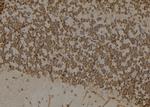 AKR1B1 Antibody in Immunohistochemistry (Paraffin) (IHC (P))