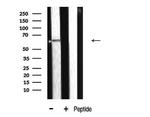 CYP2E1 Antibody in Western Blot (WB)