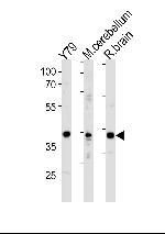 NeuroD1 Antibody in Western Blot (WB)