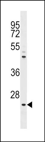 Neurogenin 1 Antibody in Western Blot (WB)