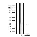 RAB13 Antibody in Western Blot (WB)