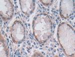 OAS2 Antibody in Immunohistochemistry (Paraffin) (IHC (P))