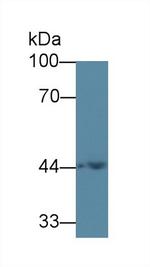 ACAA1 Antibody in Western Blot (WB)