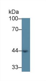 ACAA1 Antibody in Western Blot (WB)