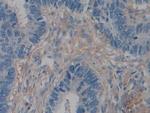 ACTG2 Antibody in Immunohistochemistry (Paraffin) (IHC (P))