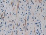 ACTG2 Antibody in Immunohistochemistry (Paraffin) (IHC (P))