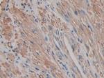 ACTG2 Antibody in Immunohistochemistry (Paraffin) (IHC (P))