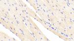 alpha Actinin 2 Antibody in Immunohistochemistry (Paraffin) (IHC (P))