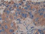 alpha Actinin 4 Antibody in Immunohistochemistry (Paraffin) (IHC (P))