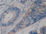 alpha Actinin 4 Antibody in Immunohistochemistry (Paraffin) (IHC (P))