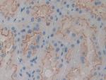 alpha Actinin 4 Antibody in Immunohistochemistry (Paraffin) (IHC (P))