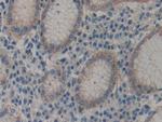 alpha Actinin 4 Antibody in Immunohistochemistry (Paraffin) (IHC (P))